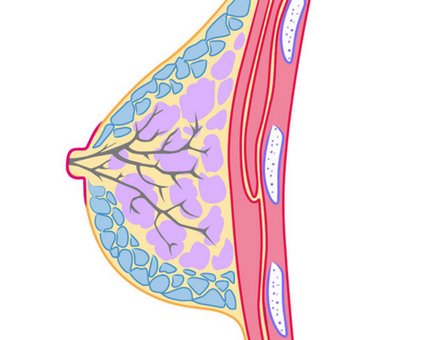 老年乳房癌前兆